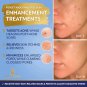 DOUBLE SIZED (2Oz) Niacinamide Serum for Face 10% with Zinc 1% Vitamin B3 Facial