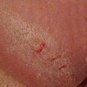 WHAT IS N.U.B.I.A.N. Series? bath, lotion, shea butter, eczema, psoriasis, dermatitis