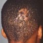 BYE, BYE ITCHY INFECTED AND DRY HAIR TREATMENT&Acirc;&reg;- shampoo, conditioner, dandruff, scalp, shea butter