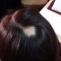 BYE, BYE ITCHY INFECTED AND DRY HAIR TREATMENT®- shampoo, conditioner, dandruff, scalp, shea butter