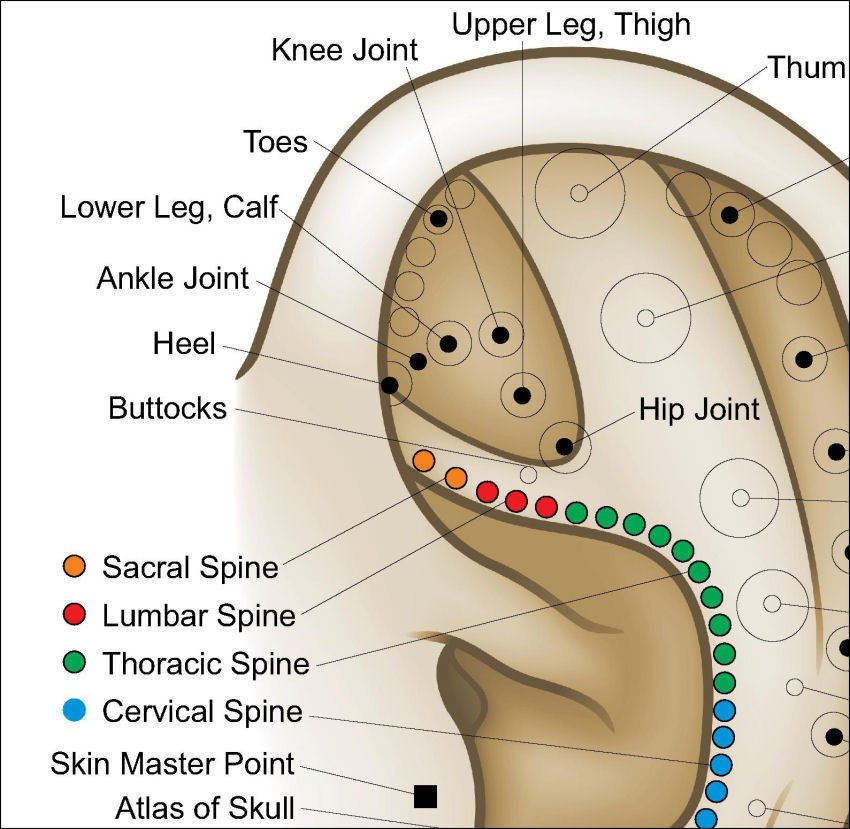 Auriculotherapy Ear Acupuncture Poster 18" X 24" Wall Chart