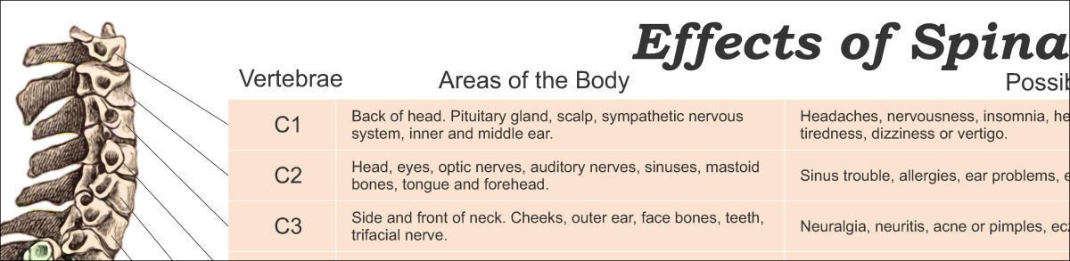 Vertebral Spinal Subluxation Symptoms Poster 24 X 36 Chiropractic Chart