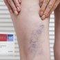 ALG Pharma Diosmina 1000 mg Forte+ Zmęczone nogi żylaki Diosmin Hesperidin Varicose Swollen Legs