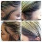 Bald Thining Scalp Intense Hair Growth Serum Triple Massager Fast Regrow Balding
