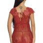 Moments Notice Lace Babydoll Set