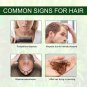Rosemary Mint Hair Growth Oil Preventing Hair Dryness, Organics Hair Care Oil