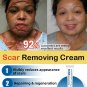 scar removal cream for old scars