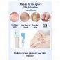 4 X Euderm Cream 45g Relieves Dry Scaly Itchy Irritated Skin & Cracked Heel
