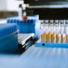 High-Throughput Enzyme Screening