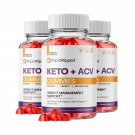 3 Pack Rapid Ripped ACV Gummies, RapidRipped For Weight Management - 180 Gummies