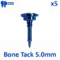 5x DSI Dental Implant GBR Guided Bone Regeneration Surgical Tack Screw 5.0mm