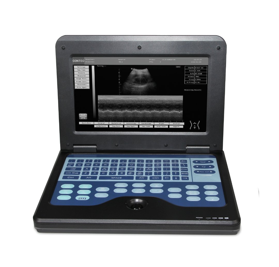 Portable Ultrasound Scanner Laptop Digital Diagnostic Machine 3.5 Convex Probe