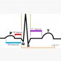 Cardiac ST Segment Rhythm Cap