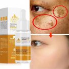 Vitamin C Whitening Freckles - Serum and Cream