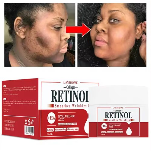 Retinol Face Dark Spots Remover Repair Products Removal Melasma Melanin Moisturizing Brighten - 50g