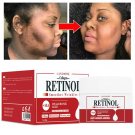 Retinol Face Dark Spots Remover Repair Products Removal Melasma Melanin Moisturizing Brighten - 50g
