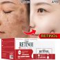 Retinol Face Dark Spots Remover Repair Products Removal Melasma Melanin Moisturizing Brighten - 50g