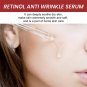 Retinol Wrinkle Remover Face Serum - BUY 2 GET 1 FREE / BUY 3 GET 2 FREE