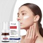 Powerful Spot-removing Whiten Serum Cream Vitamin C