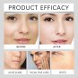 Powerful Spot-removing Whiten Serum Cream Vitamin C