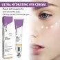 Instant Eye Bag Removal Cream Retinol Anti-Wrinkle Firming Skin