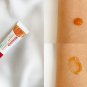 Dr.PONG CPX Scar gel, silicone Reduce scars 10 g