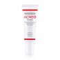Dr. Somchai Acne Cream 15 g. Cream to Dissolve Clogged Pores, Blackheads, and Whiteheads.