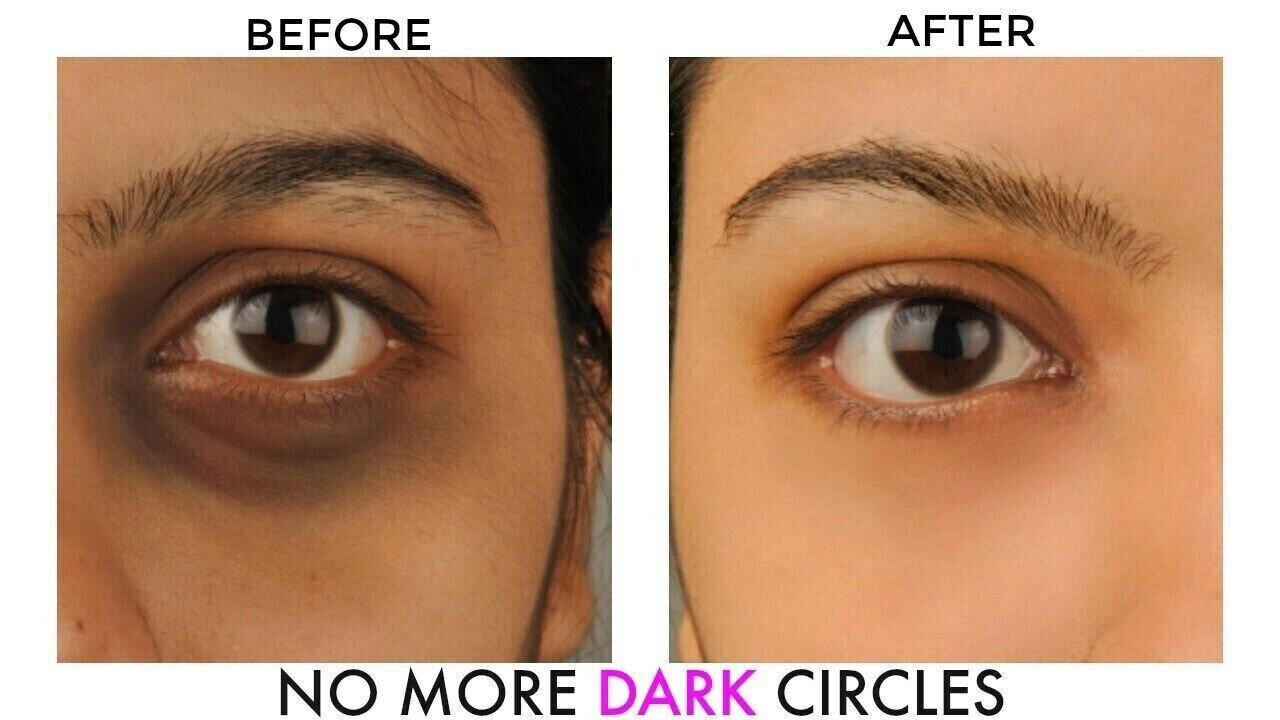 Bye Bye Dark Circles, Under Eye Cream for Dark Circles, with Cucumber 20g
