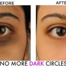 Bye Bye Dark Circles, Under Eye Cream for Dark Circles, with Cucumber 20g