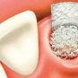 4 X B-OSTIN Truly Synthetic Biocompatible Bone Graft Substitute 0.5 CC Granules.