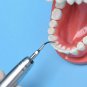 Waldent Dental Sonic Air Scaler Handpiece- Grade 1 Stains & Calculus