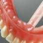 MolloSil Long Term A Silicone based Denture Relining Material FOR CHAIRSIDE USE