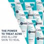 CeraVe Acne Foaming Cream Cleanser | Acne Treatment Face Wash with 4% Benzoyl Peroxide