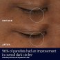 Estée Lauder Advanced Night Repair Eye Supercharged Gel-Creme