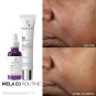 La Roche-Posay Mela B3 Serum, Dark Spot Corrector With Anti-Aging Melasyl + 10% Niacinamide