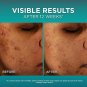 L&acirc;��Or&Atilde;&copy;al Paris Bright Reveal 12% [Niacinamide + Amino Sulfonic + Ferulic] Dark Spot Serum