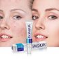 Bioaqua Pure Skin Removal of Acne Cream Pimple Scar Treatment 30g Clear Skin Face Tracking Available