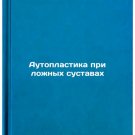 Autoplastika pri lozhnykh sustavakh. In Russian /Autoplasty for false joints