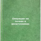 Operatsii na pochkakh i mochetochnikakh. In Russian