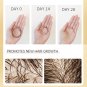 Biotin Fast Hair Growth Shampoo Anti Hair Loss Scalp Treatment For Thicker Hairs