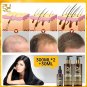Biotin Fast Hair Growth Shampoo Conditioner Oil Set Anti Hair Loss Treatment