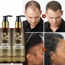Biotin Fast Hair Growth Shampoo Conditioner Set Anti Hair Loss Scalp Treatment