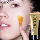 Gold Remove Blackhead Mask Shrink Pores Improve Rough Facial Skin Acne Remover