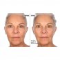 Active Argan Resurface Accelerating Peel Activated Argan Complex, 1.0 fl oz. New