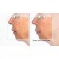 Active Argan Resurface Accelerating Peel Activated Argan Complex, 1.0 fl oz. New