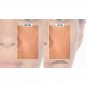 Active Argan Resurface Accelerating Peel Activated Argan Complex, 1.0 fl oz. New