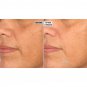 NassifMD Hydro-Screen Serum 4 oz Pump Bottle Hyaluronic Acid Retinol & Ceramides