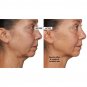 Beekman 1802 Milk RX Advanced Better Aging Renexosome Cream 1.69 fl oz. New