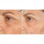 Nassif MD Peri-Orbital Complex Revitalizing Eye Cream With Elasta-Derm C & AHA.