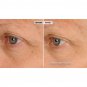 Nassif MD Peri-Orbital Complex Revitalizing Eye Cream With Elasta-Derm C & AHA.